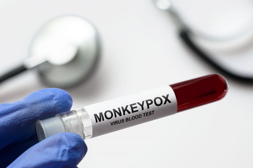 Monkeypox Testing and Treatment at AFC Monkeypox lab testing in xxxyyyzzz ^^